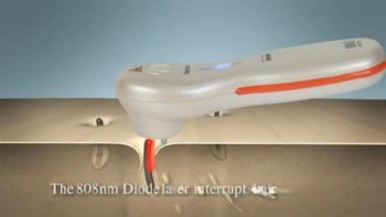 Лазерный эпилятор BENUS CW- 808 (Venus), BNB Medical Южная Корея