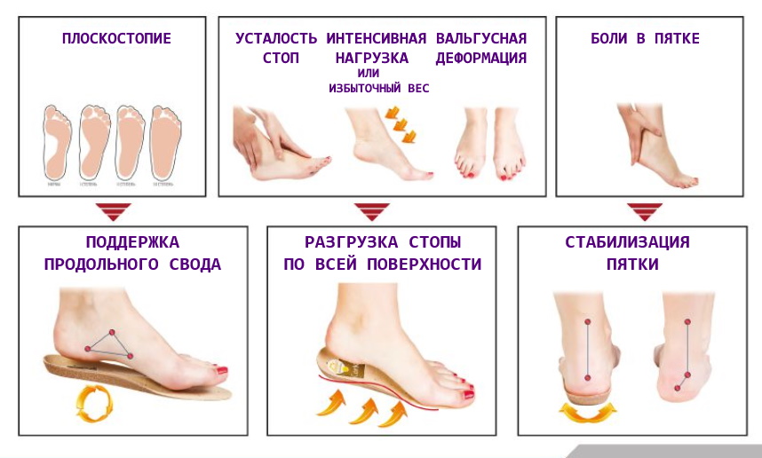 Применение стелек Spannrit Sunbed Cork Свойства стелек Spannrit Sunbed Cork